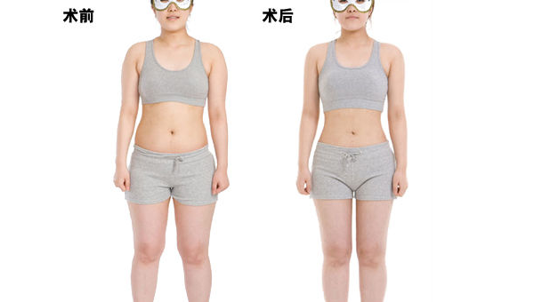 抽脂毫升能减几斤？真相揭秘